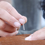 Dry Needling für Hunde